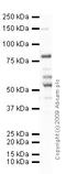 Toll Like Receptor 2 antibody, ab16894, Abcam, Western Blot image 