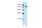 DIS3 Like 3'-5' Exoribonuclease 2 antibody, PA5-41948, Invitrogen Antibodies, Western Blot image 