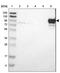 Actinin Alpha 2 antibody, NBP1-90376, Novus Biologicals, Western Blot image 