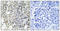 Neutrophil Cytosolic Factor 1 antibody, A01586S359, Boster Biological Technology, Immunohistochemistry paraffin image 