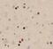 p68 antibody, FNab08938, FineTest, Immunohistochemistry paraffin image 