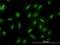 Proteasome Subunit Beta 6 antibody, H00005694-M02, Novus Biologicals, Immunofluorescence image 