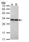 Phosphoglycerate Mutase 2 antibody, NBP1-32966, Novus Biologicals, Western Blot image 