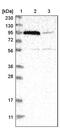 Protein FAN antibody, PA5-54708, Invitrogen Antibodies, Western Blot image 