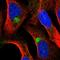 Zinc Finger Protein 774 antibody, HPA030839, Atlas Antibodies, Immunofluorescence image 