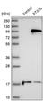 Deltex E3 Ubiquitin Ligase 3L antibody, HPA010570, Atlas Antibodies, Western Blot image 
