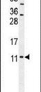 NADH:Ubiquinone Oxidoreductase Subunit A11 antibody, PA5-24022, Invitrogen Antibodies, Western Blot image 