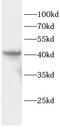 Casein Kinase 2 Alpha 1 antibody, FNab10325, FineTest, Western Blot image 