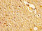 NADH dehydrogenase [ubiquinone] iron-sulfur protein 2, mitochondrial antibody, CSB-PA015661LA01HU, Cusabio, Immunohistochemistry frozen image 