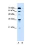 Kelch Like Family Member 31 antibody, NBP1-70594, Novus Biologicals, Western Blot image 