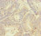 YME1 Like 1 ATPase antibody, LS-C676723, Lifespan Biosciences, Immunohistochemistry paraffin image 