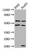 Glutamyl-TRNA Amidotransferase Subunit B antibody, CSB-PA017792LA01HU, Cusabio, Western Blot image 