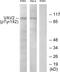 Vav Guanine Nucleotide Exchange Factor 2 antibody, PA5-38928, Invitrogen Antibodies, Western Blot image 