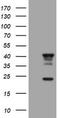 Transmembrane Protein 173 antibody, TA505032, Origene, Western Blot image 