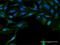 Sftpa antibody, H00653509-M07, Novus Biologicals, Immunofluorescence image 