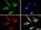 Y-Box Binding Protein 1 antibody, NBP1-97572, Novus Biologicals, Immunofluorescence image 