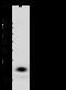 Neutrophil gelatinase-associated lipocalin antibody, 10222-T48, Sino Biological, Western Blot image 