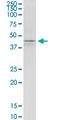Potassium Voltage-Gated Channel Subfamily J Member 5 antibody, LS-B13297, Lifespan Biosciences, Western Blot image 