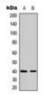 Bradykinin Receptor B1 antibody, orb393224, Biorbyt, Western Blot image 