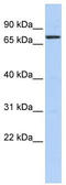 Kelch Like Family Member 5 antibody, TA345187, Origene, Western Blot image 