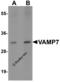 Vesicle-associated membrane protein 7 antibody, 6929, ProSci Inc, Western Blot image 