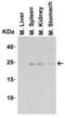 Interleukin 23 Subunit Alpha antibody, 3795, ProSci Inc, Western Blot image 