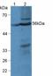 Lysophosphatidylcholine Acyltransferase 3 antibody, LS-C298573, Lifespan Biosciences, Western Blot image 