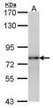 Luteinizing Hormone/Choriogonadotropin Receptor antibody, GTX100008, GeneTex, Western Blot image 