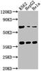 Complement factor H-related protein 5 antibody, CSB-PA883624LA01HU, Cusabio, Western Blot image 