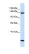 Jagged Canonical Notch Ligand 2 antibody, NBP1-58284, Novus Biologicals, Western Blot image 