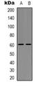 CSPG5 antibody, orb338944, Biorbyt, Western Blot image 