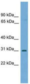 Uncharacterized protein C1orf183 antibody, TA344593, Origene, Western Blot image 