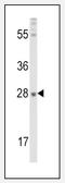 Fibroblast growth factor 10 antibody, AP14882PU-N, Origene, Western Blot image 