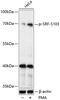 Serum Response Factor antibody, GTX66603, GeneTex, Western Blot image 