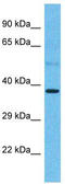 C-C chemokine receptor type 2 antibody, TA329184, Origene, Western Blot image 