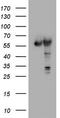 Pyruvate Kinase M1/2 antibody, TA190266, Origene, Western Blot image 