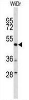 DEK Proto-Oncogene antibody, AP51234PU-N, Origene, Western Blot image 