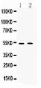 Muscarinic acetylcholine receptor M2 antibody, A02733, Boster Biological Technology, Western Blot image 