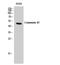 Gap Junction Protein Gamma 2 antibody, STJ92414, St John
