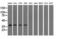 3-Hydroxyisobutyryl-CoA Hydrolase antibody, LS-C115314, Lifespan Biosciences, Western Blot image 