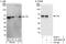 LYN Proto-Oncogene, Src Family Tyrosine Kinase antibody, A302-683A, Bethyl Labs, Western Blot image 