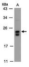 Dual Specificity Phosphatase 19 antibody, PA5-28007, Invitrogen Antibodies, Western Blot image 