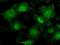 Signal Transducer And Activator Of Transcription 1 antibody, NBP1-48011, Novus Biologicals, Immunofluorescence image 