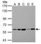 Pyruvate Kinase L/R antibody, LS-C186218, Lifespan Biosciences, Western Blot image 