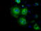 Hexokinase-2 antibody, LS-C114928, Lifespan Biosciences, Immunofluorescence image 