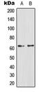 Glucagon receptor antibody, LS-C352249, Lifespan Biosciences, Western Blot image 