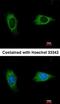 EvC Ciliary Complex Subunit 2 antibody, orb69877, Biorbyt, Immunocytochemistry image 