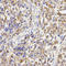 KLC1 antibody, A04116, Boster Biological Technology, Immunohistochemistry paraffin image 
