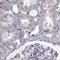 Armadillo Repeat Containing 3 antibody, PA5-58125, Invitrogen Antibodies, Immunohistochemistry frozen image 