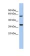 Calcium Homeostasis Modulator 3 antibody, orb326072, Biorbyt, Western Blot image 